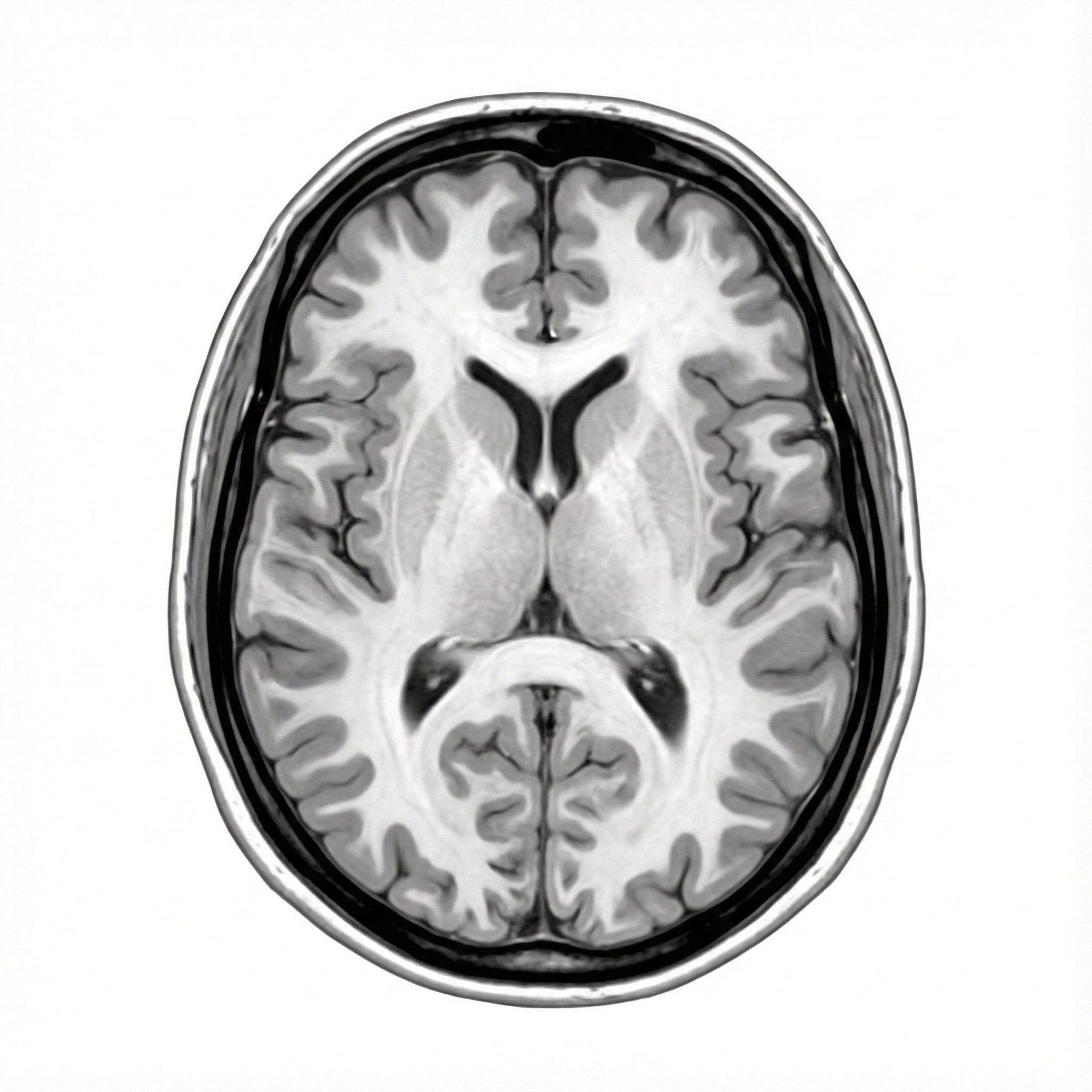 MRI.png